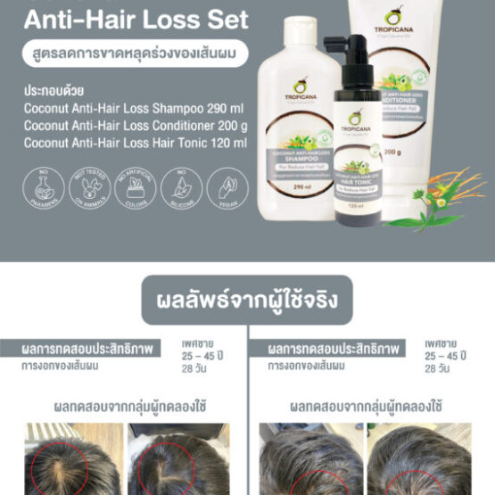 โทนิคบำรุงหนังศีรษะ สำหรับผมขาดหลุดร่วง ขนาด 120 มล. ตรา Tropicana (ทรอปิคานา) - Image 4